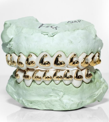 Custom Diamond Grillz